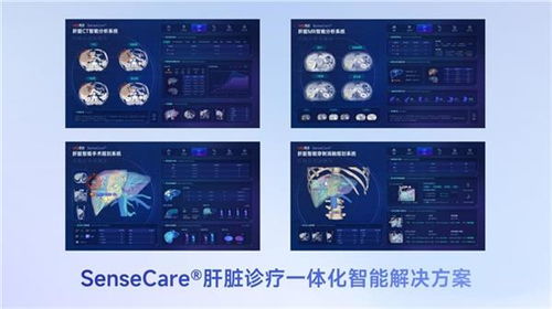 商湯醫療獲肝臟CT輔助診斷NMPA三類證，軟硬件零售賦能肝臟診療一體化新格局